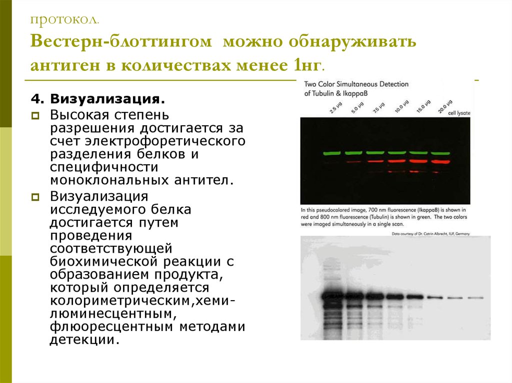 На изображении представлены результаты вестерн блоттинга. Вестерн блоттинг. Электрофоретическое Разделение белков. Вестерн-блоттинг анализ. Вестерн Блот протокол.